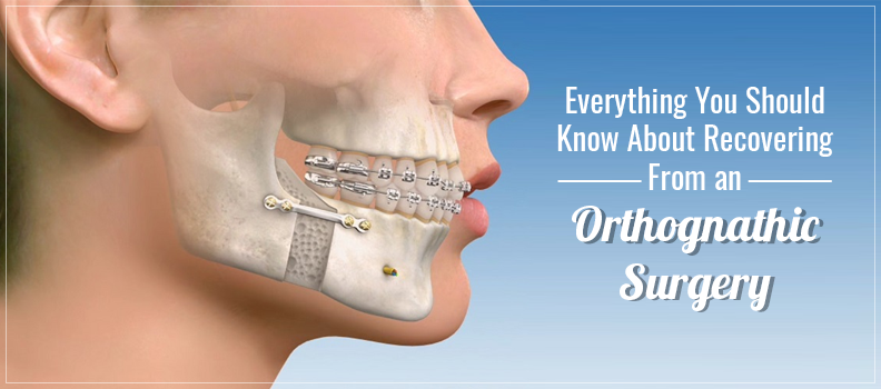 Everything You Should Know About Recovering From an Orthognathic Surgery