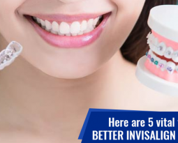 Here are 5 vital tips for a better Invisalign experience!