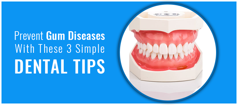 Prevent Gum Diseases With These 3  Simple Dental Tips
