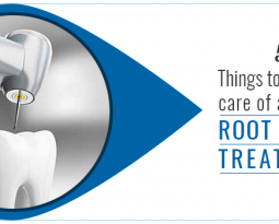 5 Things to be taken care of after the root canal treatment