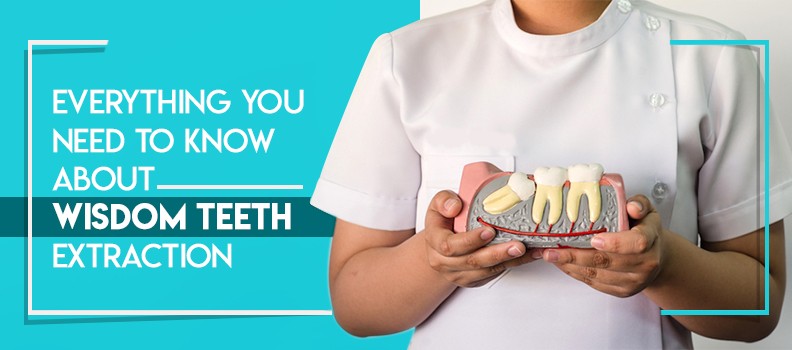Everything You Need To Know About Wisdom Teeth Extraction