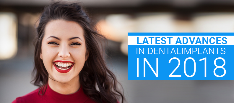 Latest Advances in Dental Implants in 2018